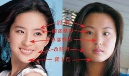 梅州整容爆料案件最新,揭开美容行业潜规则与维权困境