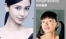 梅州整容爆料案件最新,揭开美容行业潜规则与维权困境